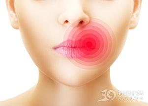 吃瓜烂嘴角怎么办啊视频,实用小妙招大揭秘